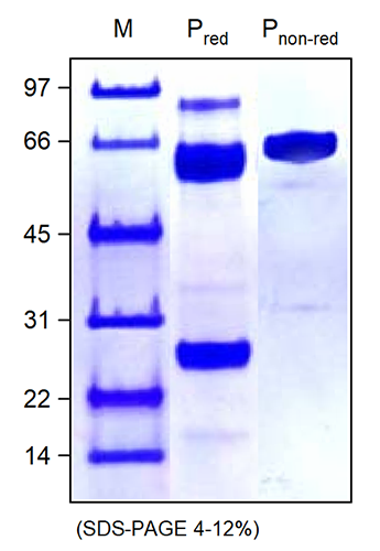 <strong>Fig. 1</strong>: SDS-PAGE of Human Plasmin (Plasma) (10g/lane). P<sub>red</sub> was reduced/heated, P<sub>non-red</sub> was not reduced/heated.