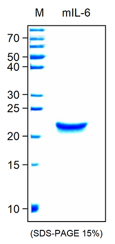 <strong>Fig. 1</strong>: SDS-PAGE analysis of recombinant Murine IL-6. Samples were loaded in 15% SDS-polyacrylamide gel under reducing conditions and stained with Coomassie blue.